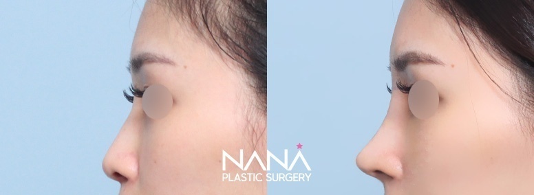 Before & After Before & After