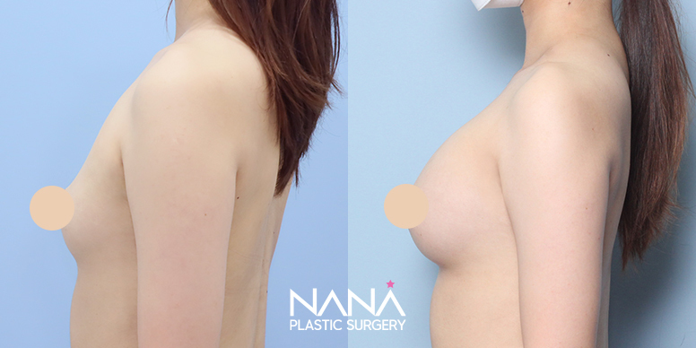 Before & After Before & After
