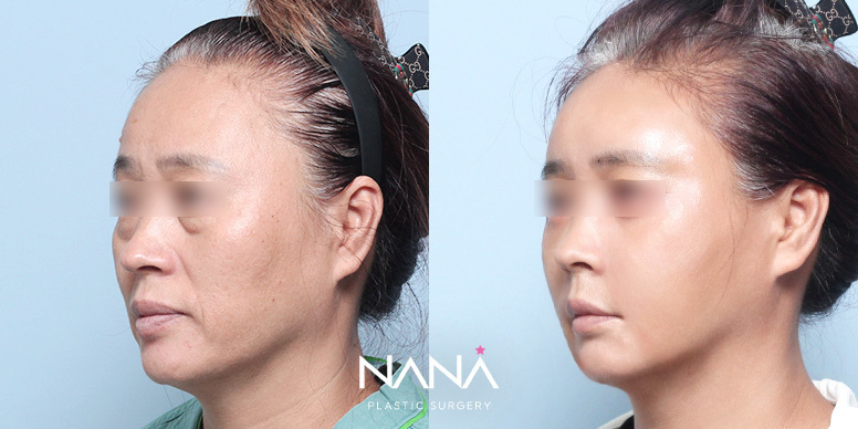 Before & After Before & After
