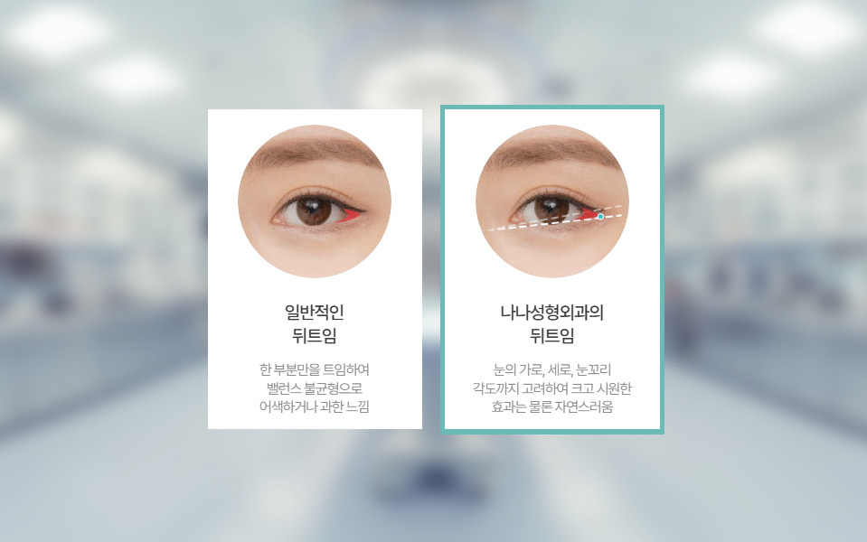 Lateral Canthoplasty NANA Plastic Surgery