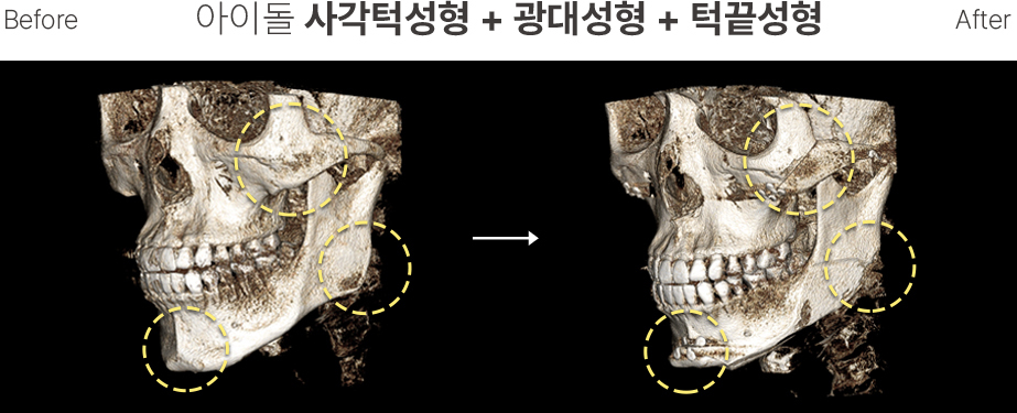 CT Scan2 Contouring Wajah Pria