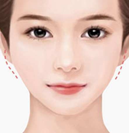 NANA Plastic Surgery<br/><b>Kapan Operasi Revisi Kontur Wajah Diperlukan?</b> - gambar detail