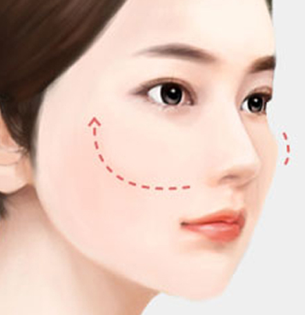 NANA Plastic Surgery<br/><b>Kapan Operasi Revisi Kontur Wajah Diperlukan?</b> - gambar detail