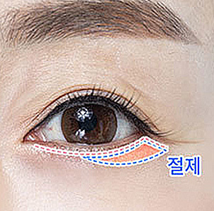 04 - gambar detail