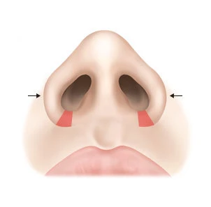 03 - gambar detail