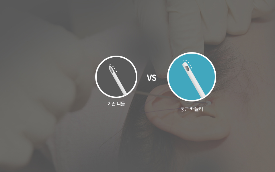 Pengangkatan Benang Nana Plastic Surgery