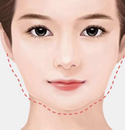 NANA Plastic Surgery<br/><b>Kapan Operasi Revisi Kontur Wajah Diperlukan?</b> - gambar detail