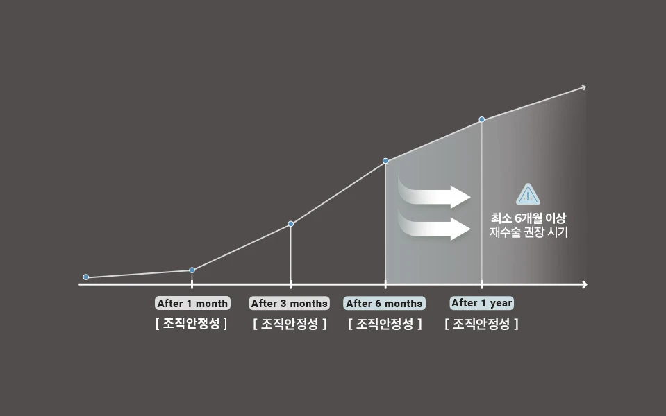 Revisi Rhinoplasty NANA Plastic Surgery