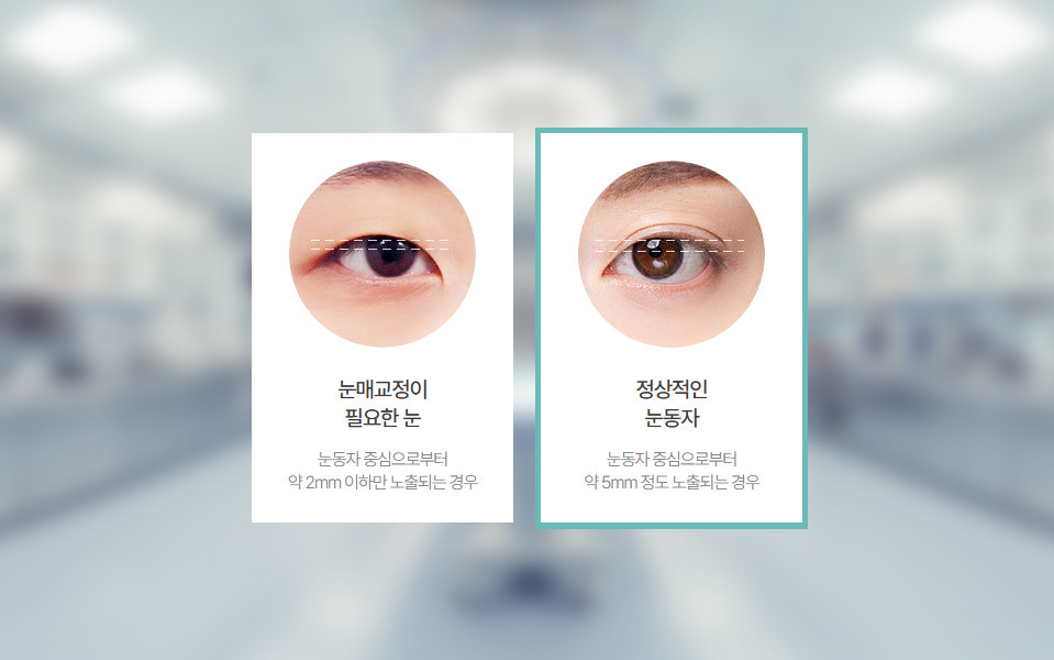 Non-incisional Ptosis Correction NANA Plastic Surgery