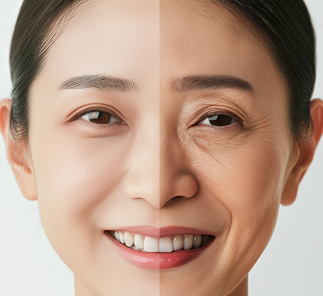 Apa Efek yang Bisa Didapatkan dari <b>Forehead Lift?</b> - gambar detail