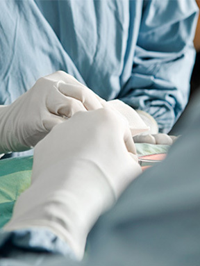 Gambar proses pelaksanaan Operasi Revisi Kontur Wajah di NANA Plastic Surgery, menampilkan tim medis yang melakukan operasi revisi dengan teknik yang presisi dan aman.