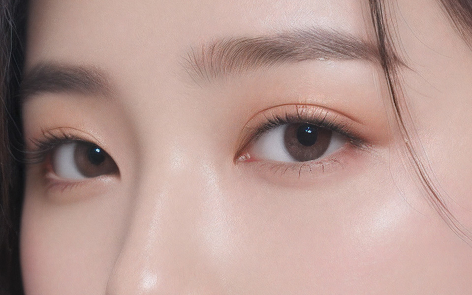 Lateral Canthoplasty NANA Plastic Surgery