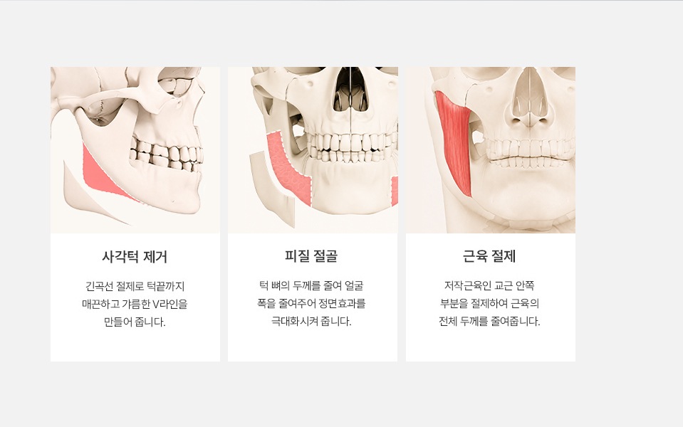 Penjelasan mengenai Operasi Revisi Rahang Bawah di NANA Plastic Surgery, termasuk metode operasi revisi yang disesuaikan dengan bentuk wajah masing-masing individu.