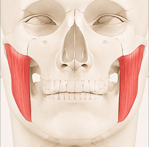 Pengecilan Otot Rahang - gambar detail