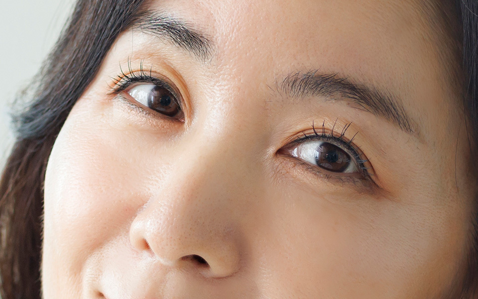NANA Plastic Surgery <b>Lower Blepharoplasty</b> - gambar detail