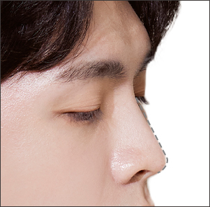 Garis Hidung Pria yang Natural dan Tegas