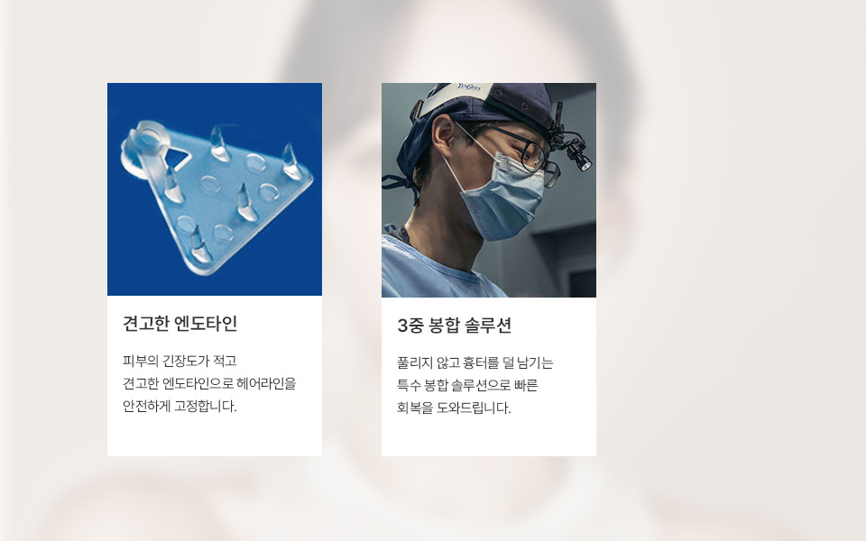 Gambar penjelasan penerapan Endotine pada Forehead Reduction NANA Plastic Surgery, yang menunjukkan bagaimana Endotine yang telah mendapat persetujuan FDA dan KFDA digunakan untuk memfiksasi jaringan dahi secara stabil.