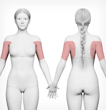 Arm Liposuction — NANA Plastic Surgery - gambar detail