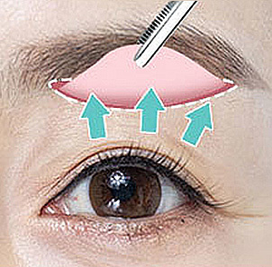 03 - gambar detail