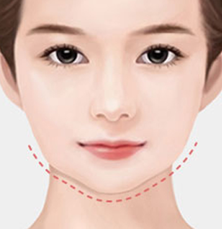 NANA Plastic Surgery<br/><b>Kapan Operasi Revisi Kontur Wajah Diperlukan?</b> - gambar detail