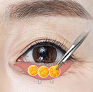 02 - gambar detail