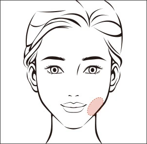 Deep Cheek (Lemak Pipi Bagian Dalam) - gambar detail
