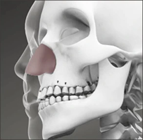 Tulang Rawan Septum Hidung - gambar detail