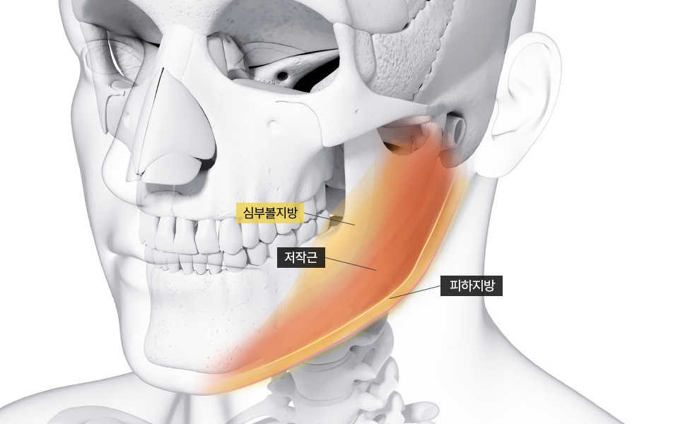 uccal Fat Removal di NANA Plastic Surgery