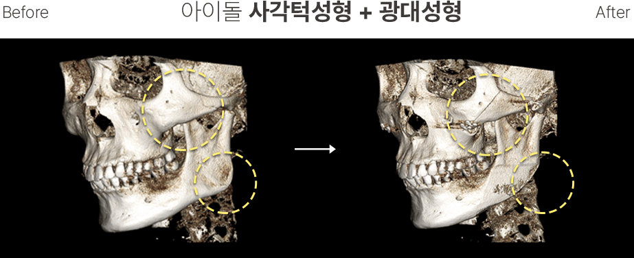 CT Scan1 Contouring Wajah Pria - gambar detail