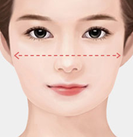 NANA Plastic Surgery<br/><b>Kapan Operasi Revisi Kontur Wajah Diperlukan?</b> - gambar detail