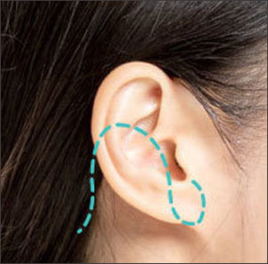 Neck Lift Keseluruhan 01 - gambar detail