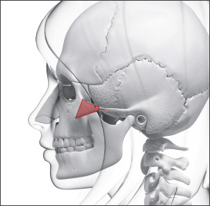 Pengecilan Tulang Pipi - gambar detail