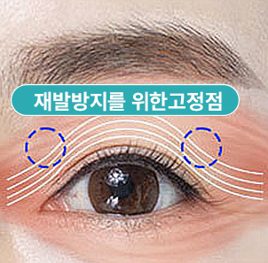04 - gambar detail