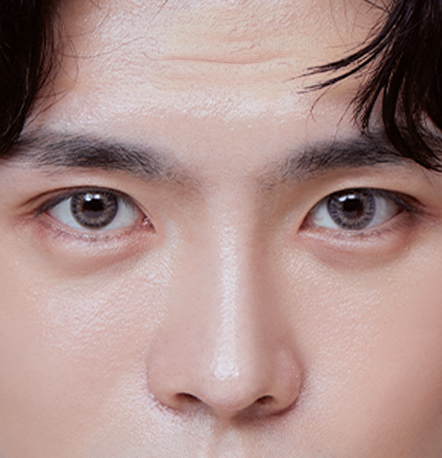 NANA Plastic Surgery Men’s Eye Surgery<br/><b>Direkomendasikan untuk Siapa?</b> - gambar detail
