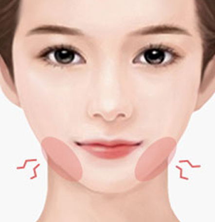 NANA Plastic Surgery<br/><b>Kapan Operasi Revisi Kontur Wajah Diperlukan?</b> - gambar detail