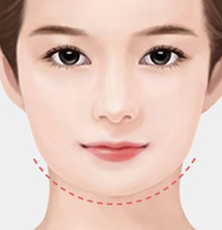 NANA Plastic Surgery<br/><b>Kapan Operasi Revisi Kontur Wajah Diperlukan?</b> - gambar detail