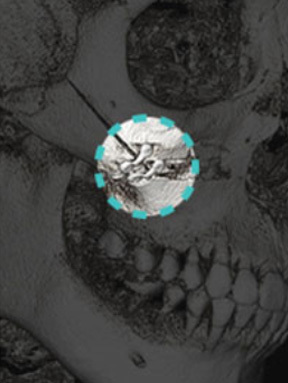 03 - gambar detail