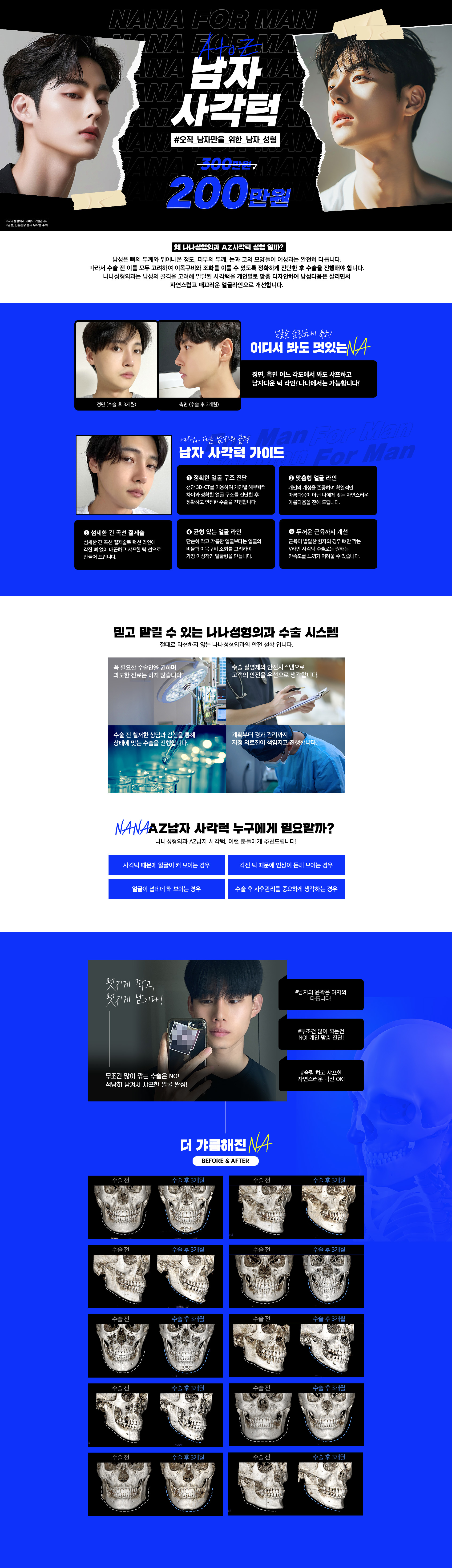 남자 AtoZ 사각턱