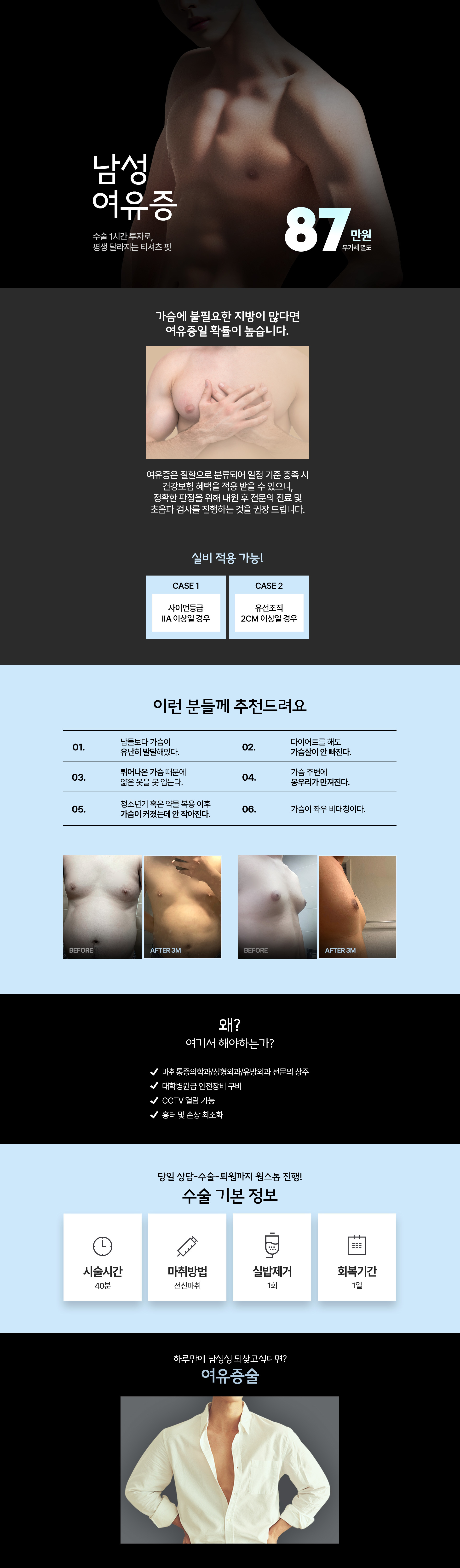 남성 여유증