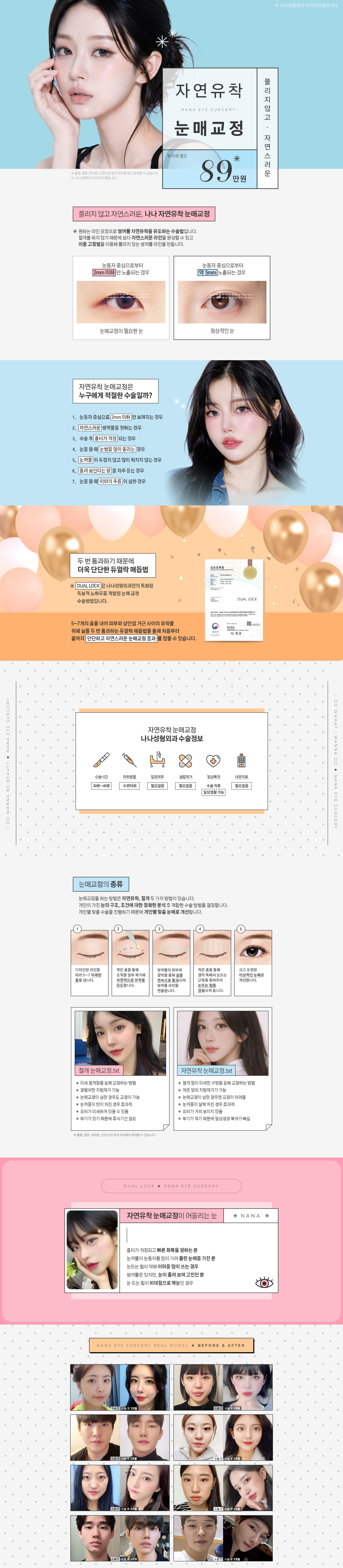 자연유착 눈매교정