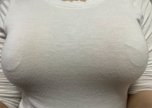 짱이쩡's Breast review