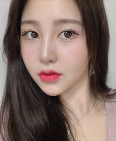 절개쌍꺼풀(재수술), 앞트임(재수술), 밑트임 후기
