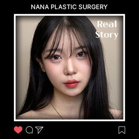 윤곽, 가슴 후기