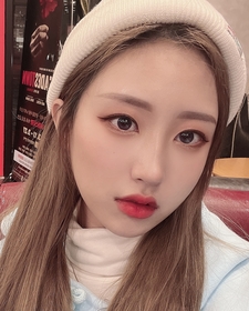 비절개눈매교정, 뒤트임 후기