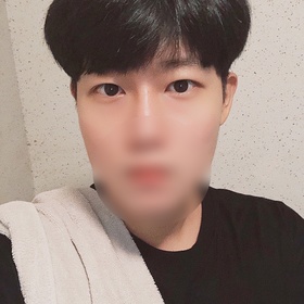 절개눈매교정 후기