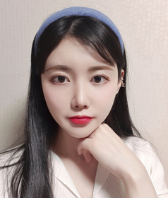 절개쌍꺼풀 재수술 후기
