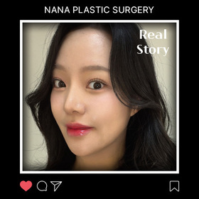 안면윤곽3종 후기