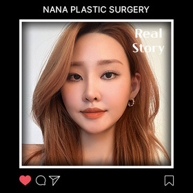 윤곽3종, 절개눈매교정 재수술, 코재수술, 가슴 후기