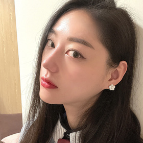 콧대 코끝 절골 매부리 후기