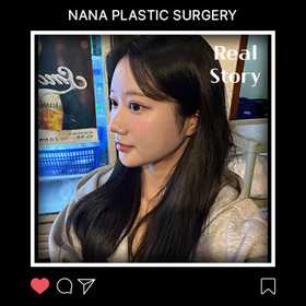 윤곽3종,비절개눈매교정,풀페이스지방이식 후기